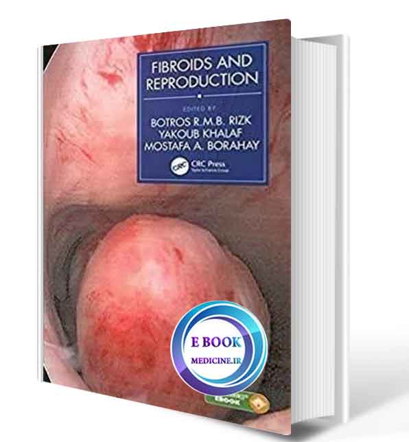 دانلود کتاب Fibroids and Reproduction2020( ORIGINAL PDF)  